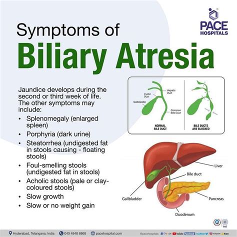 bile leakage symptoms|Leaking Bile Duct Symptoms, Causes, Diagnosis, and Treatment